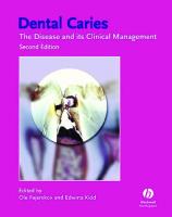 Dental Caries: The Disease and Its Clinical Management [2 ed.]
 1405138890