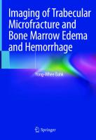 Imaging of Trabecular Microfracture and Bone Marrow Edema and Hemorrhage [1st ed.]
 9789811544651, 9789811544668