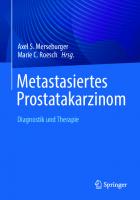 Metastasiertes Prostatakarzinom: Diagnostik und Therapie
 3662672960, 9783662672969, 9783662672976