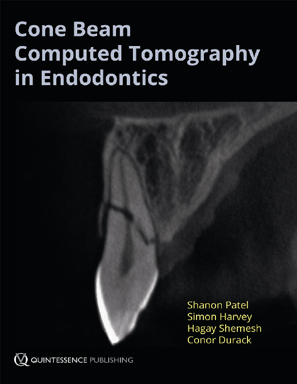 Cone Beam Computed Tomography in Endodontics [1º Edición