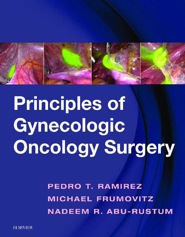 Principles Of Gynecologic Oncology Surgery 1 Nbsp Ed 9780323428781 2018008119 0323428789 0323442773 9780323442770 9780323442787 Dokumen Pub