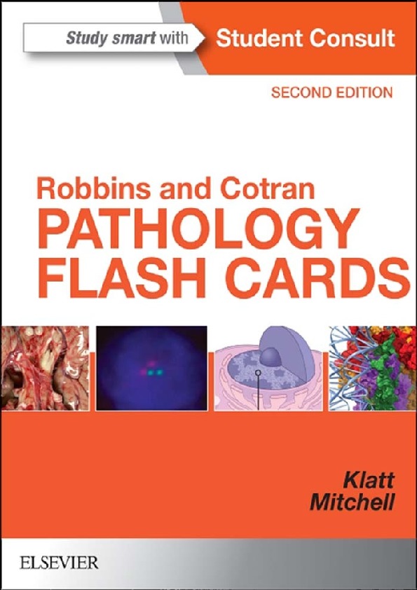 Breast Cancer - Clinical Pathology Flashcards